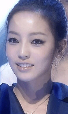 KARA ハラの歯列矯正前後画像